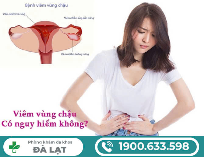 Hình ảnh minh họa